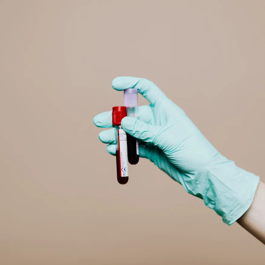 genetic examination, PANDA examination, preconception genetic testing, preimplantation genetic testing, PANDA, genetic test, genetic disorders, DNA, geneticist, genetics, genetic disorders, partner compatibility, PGT, PGT-A, PGT-M, chromosomes, euploidy, aneuploidy, miscarriage, recurrent miscarriages, hereditary diseases